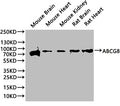 Western Blot
Positive WB detected in: Mouse Brain tissue lysate, Mouse Heart tissue lysate, Mouse Kidney tissue lysate, Rat Brain tissue lysate, Rat Heart tissue lysate
All lanes: ABCG8 antibody at 1:1000
Secondary
Goat polyclonal to rabbit IgG at 1/50000 dilution
Predicted band size: 76, 71 kDa
Observed band size: 76 kDa