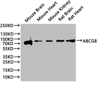 Western Blot
Positive WB detected in: Mouse Brain tissue lysate, Mouse Heart tissue lysate, Mouse Kidney tissue lysate, Rat Brain tissue lysate, Rat Heart tissue lysate
All lanes: ABCG8 antibody at 1:1000
Secondary
Goat polyclonal to rabbit IgG at 1/50000 dilution
Predicted band size: 76, 71 kDa
Observed band size: 76 kDa