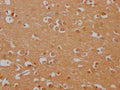 IHC image of CSB-PA875700LA01HU diluted at 1:100 and staining in paraffin-embedded human brain tissue performed on a Leica BondTM system. After dewaxing and hydration, antigen retrieval was mediated by high pressure in a citrate buffer (pH 6.0). Section was blocked with 10% normal goat serum 30min at RT. Then primary antibody (1% BSA) was incubated at 4°C overnight. The primary is detected by a Goat anti-rabbit polymer IgG labeled by HRP and visualized using 0.05% DAB.