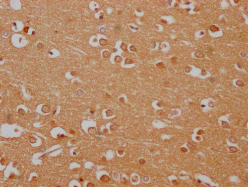 IHC image of CSB-PA875700LA01HU diluted at 1:100 and staining in paraffin-embedded human brain tissue performed on a Leica BondTM system. After dewaxing and hydration, antigen retrieval was mediated by high pressure in a citrate buffer (pH 6.0). Section was blocked with 10% normal goat serum 30min at RT. Then primary antibody (1% BSA) was incubated at 4°C overnight. The primary is detected by a Goat anti-rabbit polymer IgG labeled by HRP and visualized using 0.05% DAB.