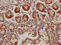 IHC image of CSB-PA875718LA01HU diluted at 1:300 and staining in paraffin-embedded human small intestine tissue performed on a Leica BondTM system. After dewaxing and hydration, antigen retrieval was mediated by high pressure in a citrate buffer (pH 6.0). Section was blocked with 10% normal goat serum 30min at RT. Then primary antibody (1% BSA) was incubated at 4°C overnight. The primary is detected by a Goat anti-rabbit polymer IgG labeled by HRP and visualized using 0.05% DAB.