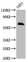 Western Blot
Positive WB detected in: U251 whole cell lysate
All lanes: MSL2 antibody at 5µg/ml
Secondary
Goat polyclonal to rabbit IgG at 1/50000 dilution
Predicted band size: 63, 55 kDa
Observed band size: 63 kDa