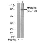 Western blot analysis of extracts from 3T3 cells using MARCKS(Phospho-Ser158) Antibody(Lane 2) and the same antibody preincubated with blocking peptide(Lane1).