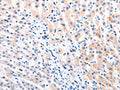 MTOR Antibody – Figure 1 of 1