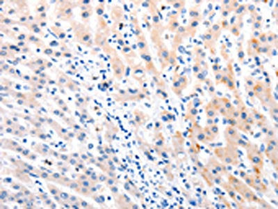 MTOR Antibody – Figure 1 of 1
