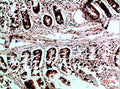 Immunohistochemical analysis of paraffin-embedded human-colon, antibody was diluted at 1:200