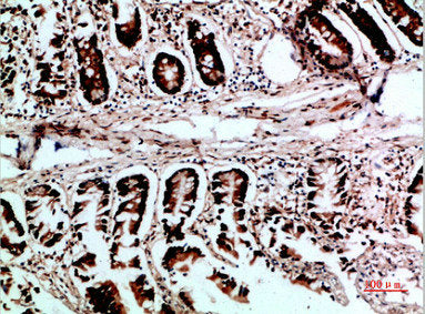 Immunohistochemical analysis of paraffin-embedded human-colon, antibody was diluted at 1:200