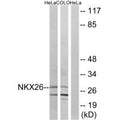Western blot analysis of extracts from HeLa cells and COLO cells, using NKX26 antibody.