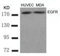 Western blot analysis of extracts from HUVEC and MDA cells using EGFR(Ab-869) Antibody.