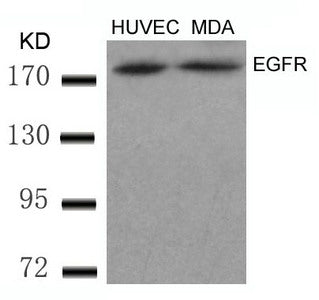 Western blot analysis of extracts from HUVEC and MDA cells using EGFR(Ab-869) Antibody.
