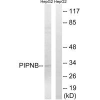 Western blot analysis of extracts from HepG2 cells, using PITPNB antibody.