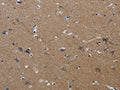 The image on the left is immunohistochemistry of paraffin-embedded Human brain tissue using CSB-PA877253(PIK3CG Antibody) at dilution 1/40, on the right is treated with synthetic peptide. (Original magnification: ×200)