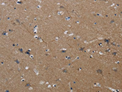 The image on the left is immunohistochemistry of paraffin-embedded Human brain tissue using CSB-PA877253(PIK3CG Antibody) at dilution 1/40, on the right is treated with synthetic peptide. (Original magnification: ×200)