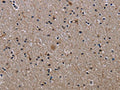 The image on the left is immunohistochemistry of paraffin-embedded Human brain tissue using CSB-PA877324(ITGB2 Antibody) at dilution 1/50, on the right is treated with fusion protein. (Original magnification: ×200)