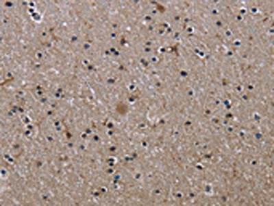 The image on the left is immunohistochemistry of paraffin-embedded Human brain tissue using CSB-PA877324(ITGB2 Antibody) at dilution 1/50, on the right is treated with fusion protein. (Original magnification: ×200)