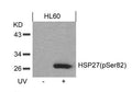 Western blot analysis of extracts from HL60 cells untreated or treated with UV using HSP27(Phospho-Ser82) Antibody.