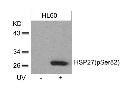 Western blot analysis of extracts from HL60 cells untreated or treated with UV using HSP27(Phospho-Ser82) Antibody.