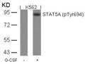 Western blot analysis of extracts from K562 cells untreated or treated with G-CSF using STAT5A(Phospho-Tyr694) Antibody.