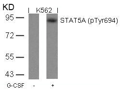 Western blot analysis of extracts from K562 cells untreated or treated with G-CSF using STAT5A(Phospho-Tyr694) Antibody.