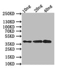 Western Blot
Positive WB detected in: recombinant protein
All lanes:SBT6.1 Antibody at 1:1000
Secondary
Goat polyclonal to rabbit IgG at 1/50000 dilution
Predicted band size: 36.6 kDa
Observed band size: 37 kDa