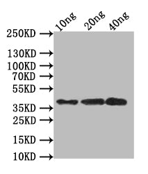 Western Blot
Positive WB detected in: recombinant protein
All lanes:SBT6.1 Antibody at 1:1000
Secondary
Goat polyclonal to rabbit IgG at 1/50000 dilution
Predicted band size: 36.6 kDa
Observed band size: 37 kDa