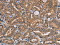 TRAFD1 Antibody – Figure 1 of 3