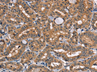 TRAFD1 Antibody – Figure 1 of 3