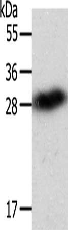 Gel: 12%SDS-PAGE, Lysate: 40 ug, Lane: SP20 cells, Primary antibody: CSB-PA877650(SPIN2B Antibody) at dilution 1/100, Secondary antibody: Goat anti rabbit IgG at 1/8000 dilution, Exposure time: 1 minute