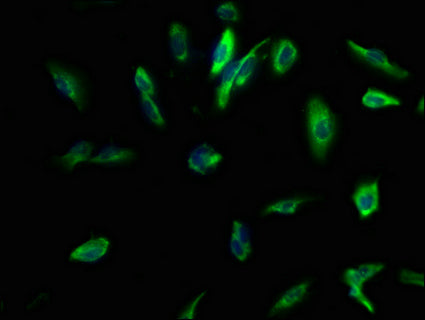 Immunofluorescence staining of U251 cells with CSB-PA878838LA01HU at 1:100, counter-stained with DAPI. The cells were fixed in 4% formaldehyde, permeabilized using 0.2% Triton X-100 and blocked in 10% normal Goat Serum. The cells were then incubated with the antibody overnight at 4°C. The secondary antibody was Alexa Fluor 488-congugated AffiniPure Goat Anti-Rabbit IgG(H+L).