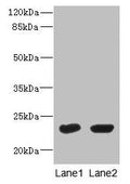 Western Blot
All lanes: UBE2T antibody at 10µg/ml
Lane 1: HepG2 whole cell lysate
Lane 2: Hela whole cell lysate
Secondary
Goat polyclonal to rabbit IgG at 1/10000 dilution
Predicted band size: 23 kDa
Observed band size: 23 kDa