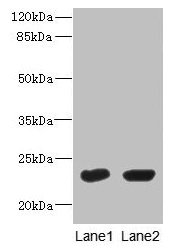 Western Blot
All lanes: UBE2T antibody at 10µg/ml
Lane 1: HepG2 whole cell lysate
Lane 2: Hela whole cell lysate
Secondary
Goat polyclonal to rabbit IgG at 1/10000 dilution
Predicted band size: 23 kDa
Observed band size: 23 kDa