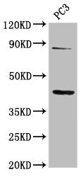 Western Blot
Positive WB detected in: PC-3 whole cell lysate
All lanes: TNFRSF19 antibody at 2.36ug/ml
Secondary
Goat polyclonal to rabbit IgG at 1/50000 dilution
Predicted band size: 47, 46, 31 kDa
Observed band size: 47 kDa