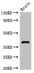 Western Blot
Positive WB detected in: Mouse brain tissue
All lanes: HOMER3 antibody at 2.7ug/ml
Secondary
Goat polyclonal to rabbit IgG at 1/50000 dilution
Predicted band size: 40, 17, 14, 36 kDa
Observed band size: 40 kDa