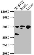 Western Blot
Positive WB detected in: SH-SY5Y whole cell lysate, Rat brain tissue, Rat liver tissue
All lanes: SEPT11 antibody at 1:2000
Secondary
Goat polyclonal to rabbit IgG at 1/50000 dilution
Predicted band size: 50, 51 kDa
Observed band size: 50 kDa