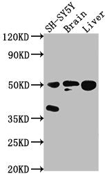 Western Blot
Positive WB detected in: SH-SY5Y whole cell lysate, Rat brain tissue, Rat liver tissue
All lanes: SEPT11 antibody at 1:2000
Secondary
Goat polyclonal to rabbit IgG at 1/50000 dilution
Predicted band size: 50, 51 kDa
Observed band size: 50 kDa