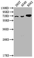 Western Blot
Positive WB detected in: 293T whole cell lysate, A549 whole cell lysate, K562 whole cell lysate
All lanes: ATAD3A antibody at 1:2000
Secondary
Goat polyclonal to rabbit IgG at 1/50000 dilution
Predicted band size: 72, 67, 58 kDa
Observed band size: 72 kDa