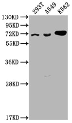 Western Blot
Positive WB detected in: 293T whole cell lysate, A549 whole cell lysate, K562 whole cell lysate
All lanes: ATAD3A antibody at 1:2000
Secondary
Goat polyclonal to rabbit IgG at 1/50000 dilution
Predicted band size: 72, 67, 58 kDa
Observed band size: 72 kDa