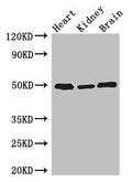 Western Blot
Positive WB detected in: Mouse heart tissue, Mouse kidney tissue, Mouse brain tissue
All lanes: ANKRD10 antibody at 4ug/ml
Secondary
Goat polyclonal to rabbit IgG at 1/50000 dilution
Predicted band size: 45, 24 kDa
Observed band size: 50 kDa