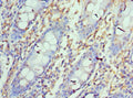 Immunohistochemistry of paraffin-embedded human colon tissue using CSB-PA878942ESR1HUat dilution of 1:100