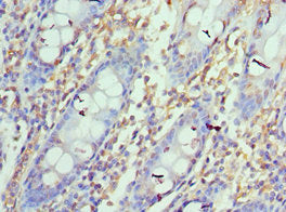 Immunohistochemistry of paraffin-embedded human colon tissue using CSB-PA878942ESR1HUat dilution of 1:100