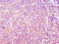 Immunohistochemistry of paraffin-embedded human tonsil tissue using CSB-PA878955ESR2HU at dilution of 1:100