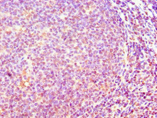 Immunohistochemistry of paraffin-embedded human tonsil tissue using CSB-PA878955ESR2HU at dilution of 1:100