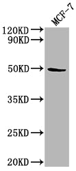 Western Blot
Positive WB detected in: MCF-7 whole cell lysate
All lanes: KLK11 antibody at 1:2000
Secondary
Goat polyclonal to rabbit IgG at 1/50000 dilution
Predicted band size: 32, 28, 34, 31 kDa
Observed band size: 50 kDa