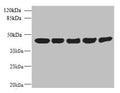 Western blot
All lanes: ACTRT3 antibody at 2.5ug/ml
Lane 1: MCF-7 whole cell lysate
Lane 2: HCT116 whole cell lysate
Lane 3: K562 whole cell lysate
Lane 4: 293T whole cell lysate
Lane 5: Hela whole cell lysate
Secondary
Goat polyclonal to rabbit IgG at 1/10000 dilution
Predicted band size: 42 kDa
Observed band size: 42 kDa
