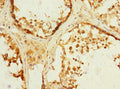 Immunohistochemistry of paraffin-embedded human testis tissue using CSB-PA880929ESR1HU at dilution of 1:100