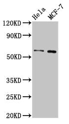 Western Blot
Positive WB detected in: Hela whole cell lysate, MCF-7 whole cell lysate
All lanes: MMP28 antibody at 3.2µg/ml
Secondary
Goat polyclonal to rabbit IgG at 1/50000 dilution
Predicted band size: 59, 15 kDa
Observed band size: 59 kDa