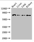Western Blot
Positive WB detected in: Mouse heart tissue, Mouse liver tissue, Mouse lung tissue, Mouse kidney tissue
All lanes: FZD8 antibody at 2.7ug/ml
Secondary
Goat polyclonal to rabbit IgG at 1/50000 dilution
Predicted band size: 74 kDa
Observed band size: 74 kDa
