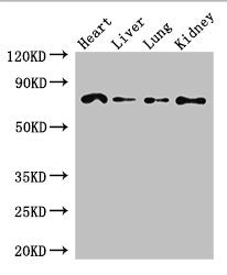 Western Blot
Positive WB detected in: Mouse heart tissue, Mouse liver tissue, Mouse lung tissue, Mouse kidney tissue
All lanes: FZD8 antibody at 2.7ug/ml
Secondary
Goat polyclonal to rabbit IgG at 1/50000 dilution
Predicted band size: 74 kDa
Observed band size: 74 kDa
