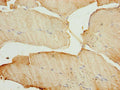 Immunohistochemistry of paraffin-embedded human skeletal muscle tissue using CSB-PA880971DA01HU at dilution of 1:100