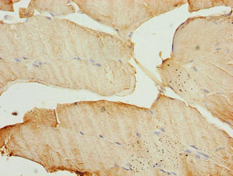 Immunohistochemistry of paraffin-embedded human skeletal muscle tissue using CSB-PA880971DA01HU at dilution of 1:100